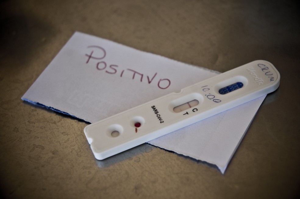 Rondônia registra 892 novos casos de Covid-19 e 18 óbitos em 24 horas Rondônia registra 892 novos casos de Covid-19 e 18 óbitos em 24 horas