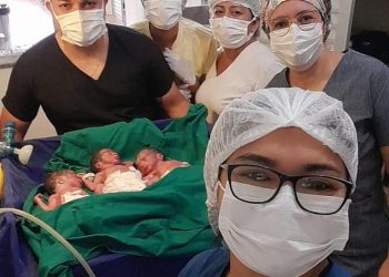 Médico se surpreende ao ‘descobrir’ 3º bebê durante parto de gêmeos no AM