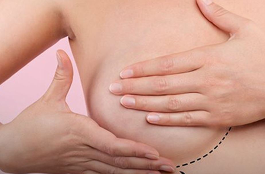 Femama alerta sobre mamografias após vacina contra covid-19 Femama alerta sobre mamografias após vacina contra covid-19