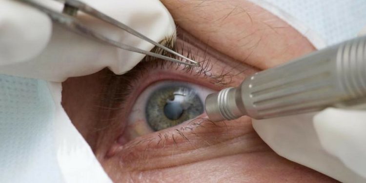 Pandemia impede realização de mais de 1 milhão de cirurgias em um ano