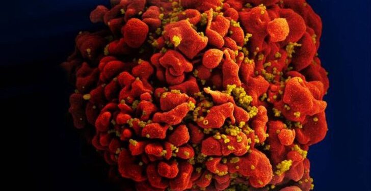Mulher pode ter sido curada do HIV pelo seu próprio sistema imunológico, dizem médicos