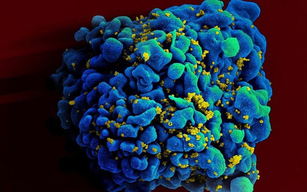 Vacina experimental contra HIV é segura e tem bons resultados em animais Vacina experimental contra HIV é segura e tem bons resultados em animais