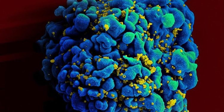 Vacina experimental contra HIV é segura e tem bons resultados em animais Vacina experimental contra HIV é segura e tem bons resultados em animais