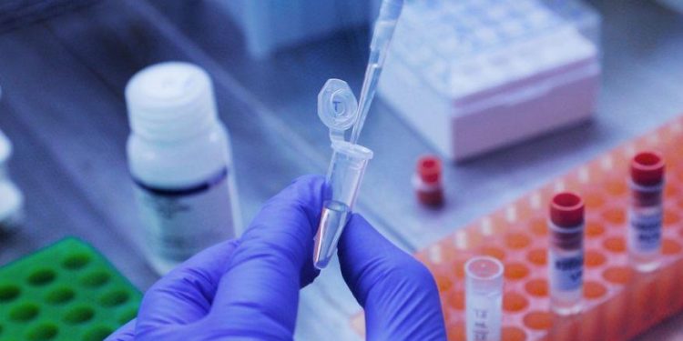 Brasil registra primeira morte pela variante Ômicron Brasil registra primeira morte pela variante Ômicron