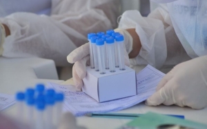 Rondônia registra 2.790 novos casos de Covid e 72 mortes na segunda-feira(14) Rondônia registra 2.790 novos casos de Covid e 72 mortes na segunda-feira(14)