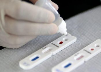 Anvisa aprova primeiro autoteste para Covid-19 no Brasil