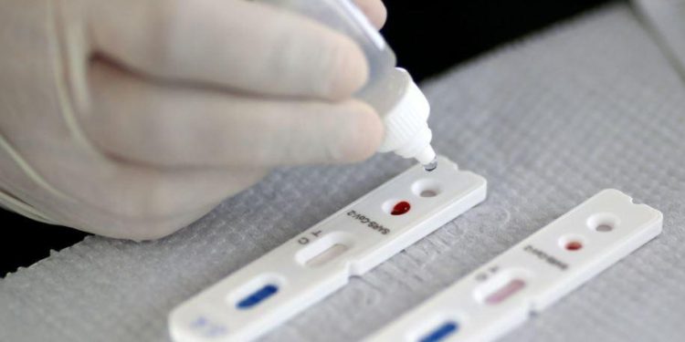 Anvisa aprova primeiro autoteste para Covid-19 no Brasil Anvisa aprova primeiro autoteste para Covid-19 no Brasil
