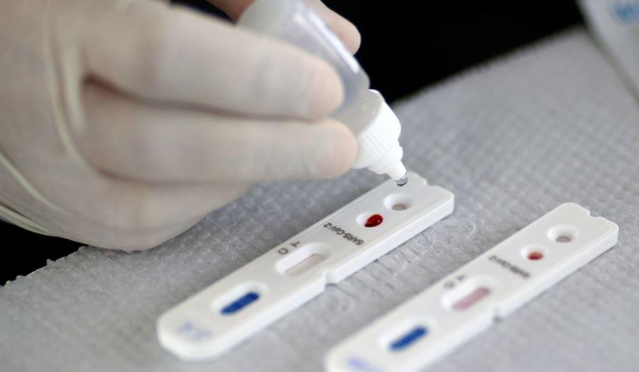 Anvisa aprova primeiro autoteste para Covid-19 no Brasil Anvisa aprova primeiro autoteste para Covid-19 no Brasil