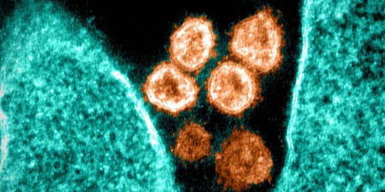 Cientistas descobrem método que impede totalmente a infecção pelo coronavírus Cientistas descobrem método que impede totalmente a infecção pelo coronavírus
