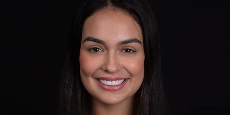 Avaliado em R$ 60 mil, ex BBB Larissa Santos troca lentes de contato dental com Dr Viotto