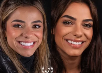 Key Alves gasta R mil para mudar as lentes de porcelana – Veja antes e depois