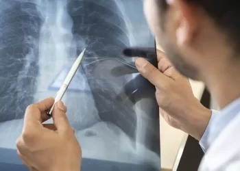 Anvisa aprova Emrelis, novo medicamento para câncer de pulmão avançado